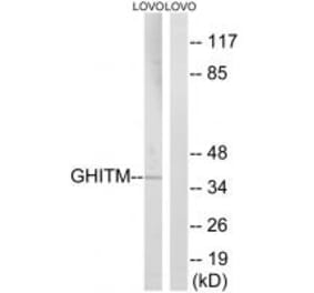 Western blot - GHITM Antibody from Signalway Antibody (34709) - Antibodies.com