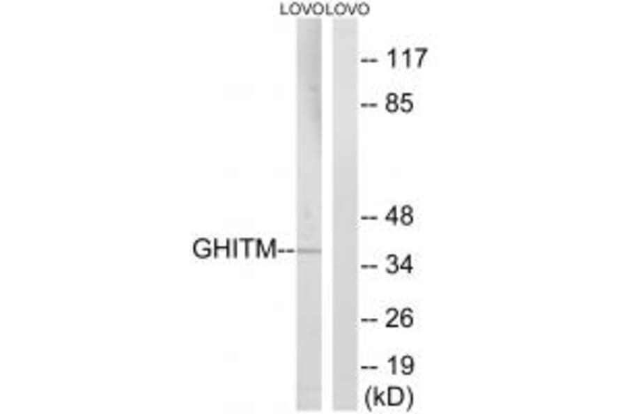 Western blot - GHITM Antibody from Signalway Antibody (34709) - Antibodies.com