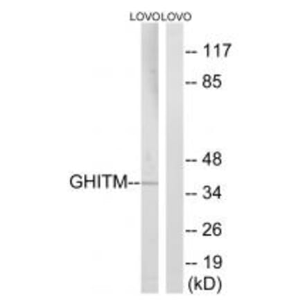 Western blot - GHITM Antibody from Signalway Antibody (34709) - Antibodies.com