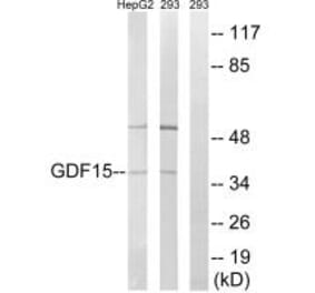 Western blot - GDF15 Antibody from Signalway Antibody (34712) - Antibodies.com