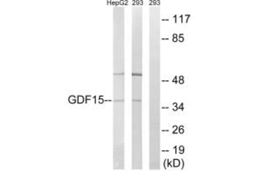 Western blot - GDF15 Antibody from Signalway Antibody (34712) - Antibodies.com