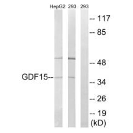 Western blot - GDF15 Antibody from Signalway Antibody (34712) - Antibodies.com