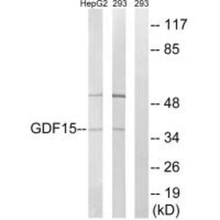 Western blot - GDF15 Antibody from Signalway Antibody (34712) - Antibodies.com