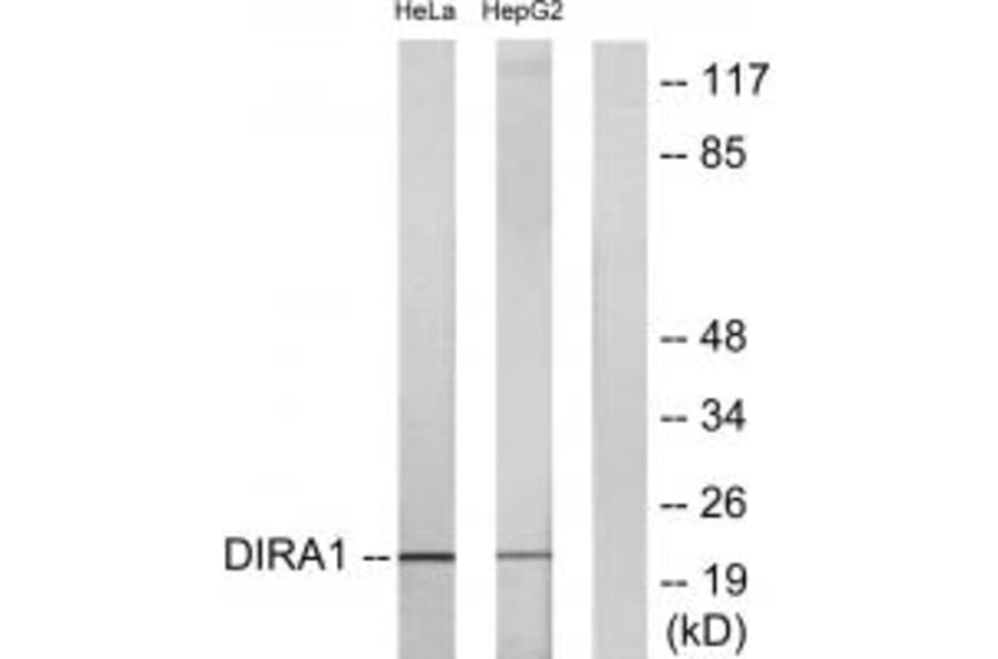 Western blot - DIRA1 Antibody from Signalway Antibody (34721) - Antibodies.com