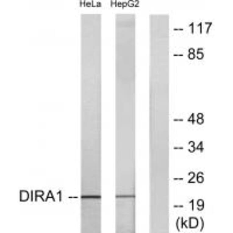Western blot - DIRA1 Antibody from Signalway Antibody (34721) - Antibodies.com