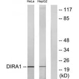 Western blot - DIRA1 Antibody from Signalway Antibody (34721) - Antibodies.com
