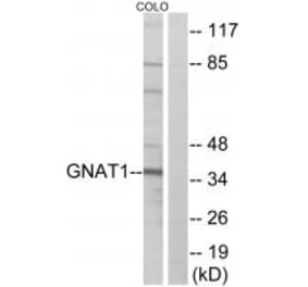 Western blot - GNAT1 Antibody from Signalway Antibody (34728) - Antibodies.com