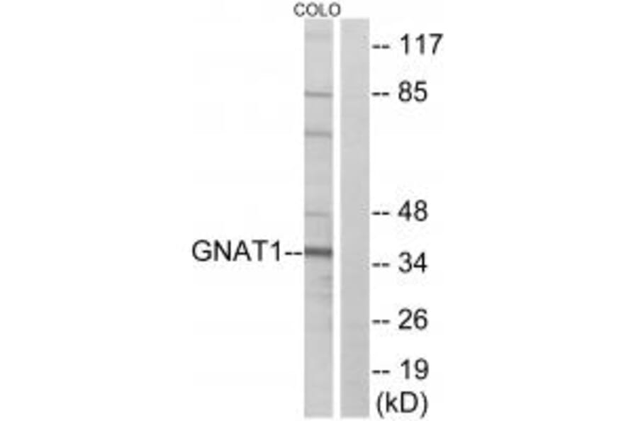 Western blot - GNAT1 Antibody from Signalway Antibody (34728) - Antibodies.com