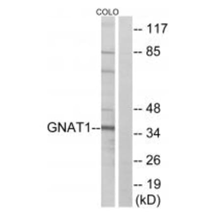 Western blot - GNAT1 Antibody from Signalway Antibody (34728) - Antibodies.com