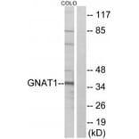 Western blot - GNAT1 Antibody from Signalway Antibody (34728) - Antibodies.com