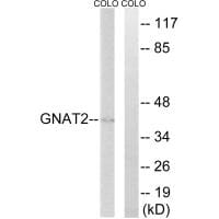 Western blot analysis of extracts from COLO cells, using GNAT2 antibody #34729.