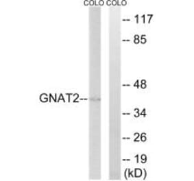 Western blot - GNAT2 Antibody from Signalway Antibody (34729) - Antibodies.com