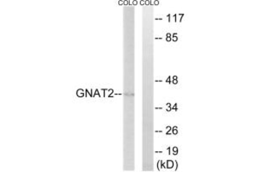 Western blot - GNAT2 Antibody from Signalway Antibody (34729) - Antibodies.com