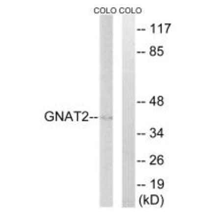 Western blot - GNAT2 Antibody from Signalway Antibody (34729) - Antibodies.com