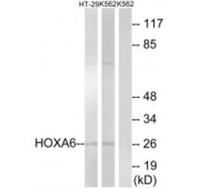 Western blot - HOXA6 Antibody from Signalway Antibody (34741) - Antibodies.com