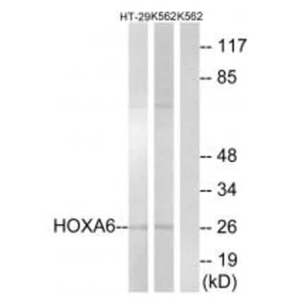 Western blot - HOXA6 Antibody from Signalway Antibody (34741) - Antibodies.com