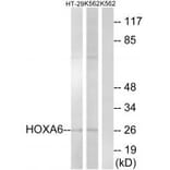 Western blot - HOXA6 Antibody from Signalway Antibody (34741) - Antibodies.com