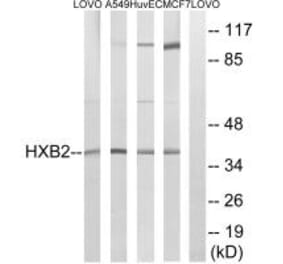 Western blot - HOXB2 Antibody from Signalway Antibody (34742) - Antibodies.com