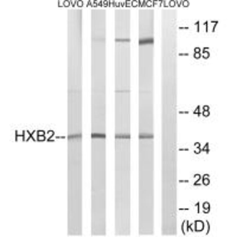 Western blot - HOXB2 Antibody from Signalway Antibody (34742) - Antibodies.com