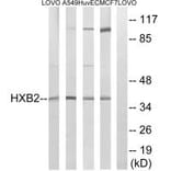 Western blot - HOXB2 Antibody from Signalway Antibody (34742) - Antibodies.com