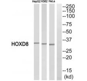 Western blot - HOXD8 Antibody from Signalway Antibody (34743) - Antibodies.com