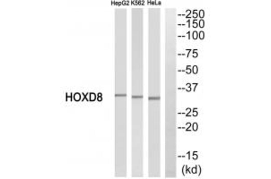 Western blot - HOXD8 Antibody from Signalway Antibody (34743) - Antibodies.com