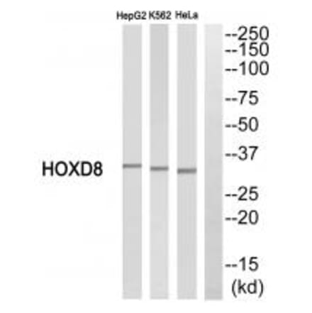Western blot - HOXD8 Antibody from Signalway Antibody (34743) - Antibodies.com