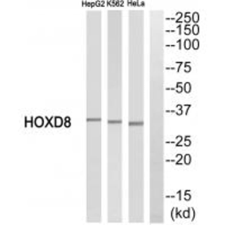 Western blot - HOXD8 Antibody from Signalway Antibody (34743) - Antibodies.com