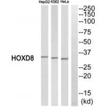 Western blot - HOXD8 Antibody from Signalway Antibody (34743) - Antibodies.com