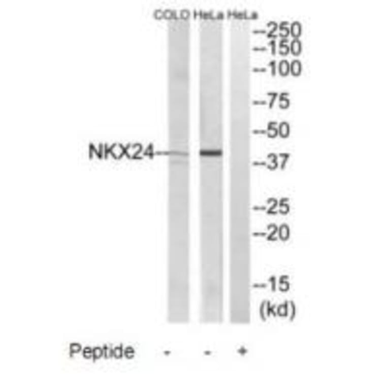 Western blot - NKX24 Antibody from Signalway Antibody (34745) - Antibodies.com