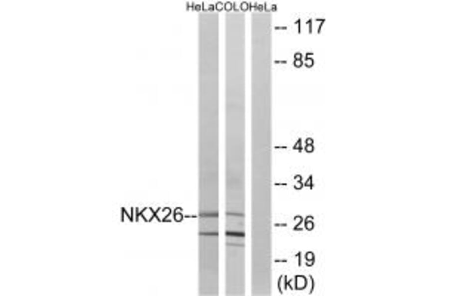 Western blot - NKX26 Antibody from Signalway Antibody (34746) - Antibodies.com