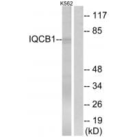 Western blot analysis of extracts from K562 cells, using IQCB1 antibody #34750.