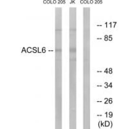 Western blot - ACSL6 Antibody from Signalway Antibody (34762) - Antibodies.com