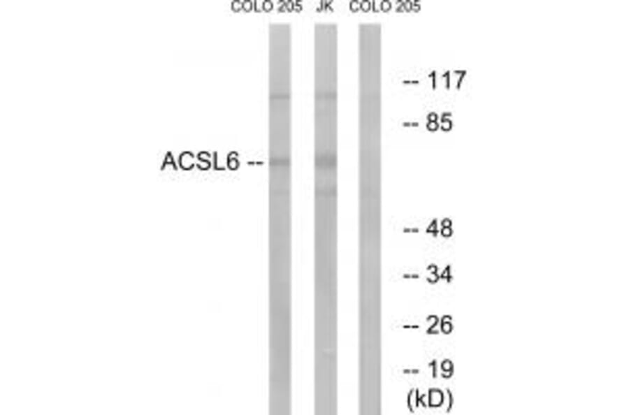 Western blot - ACSL6 Antibody from Signalway Antibody (34762) - Antibodies.com