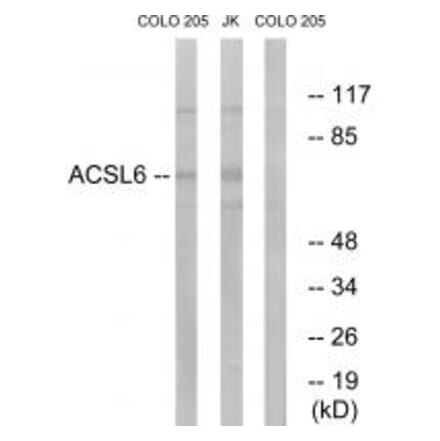 Western blot - ACSL6 Antibody from Signalway Antibody (34762) - Antibodies.com