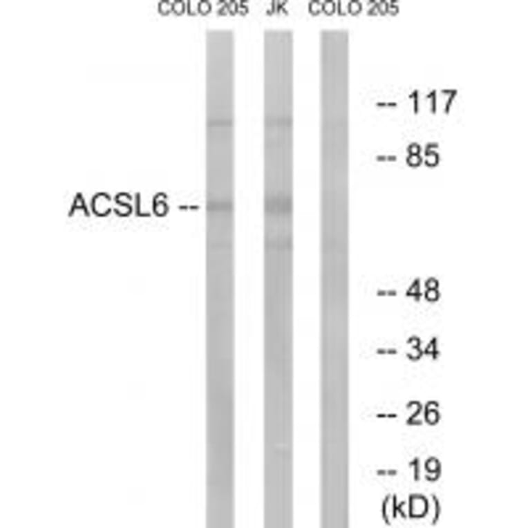 Western blot - ACSL6 Antibody from Signalway Antibody (34762) - Antibodies.com