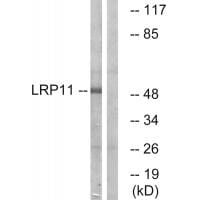 Western blot analysis of extracts from Jurkat cells, using LRP11 antibody #34767.