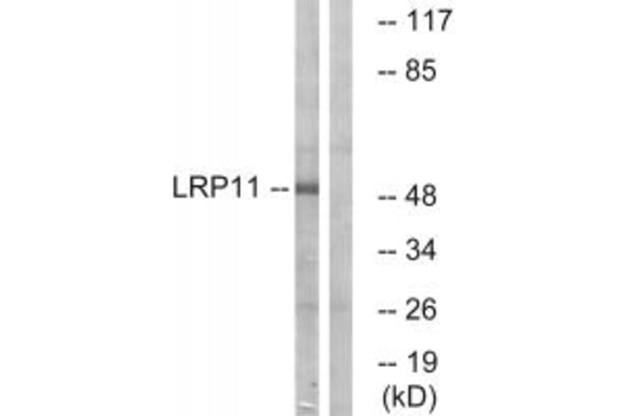 Western blot - LRP11 Antibody from Signalway Antibody (34767) - Antibodies.com