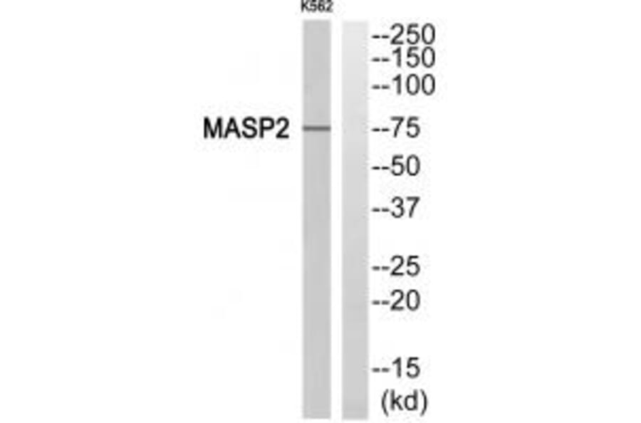 Western blot - MASP2 Antibody from Signalway Antibody (34775) - Antibodies.com