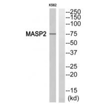 Western blot - MASP2 Antibody from Signalway Antibody (34775) - Antibodies.com