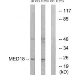 Western blot - MED18 Antibody from Signalway Antibody (34777) - Antibodies.com