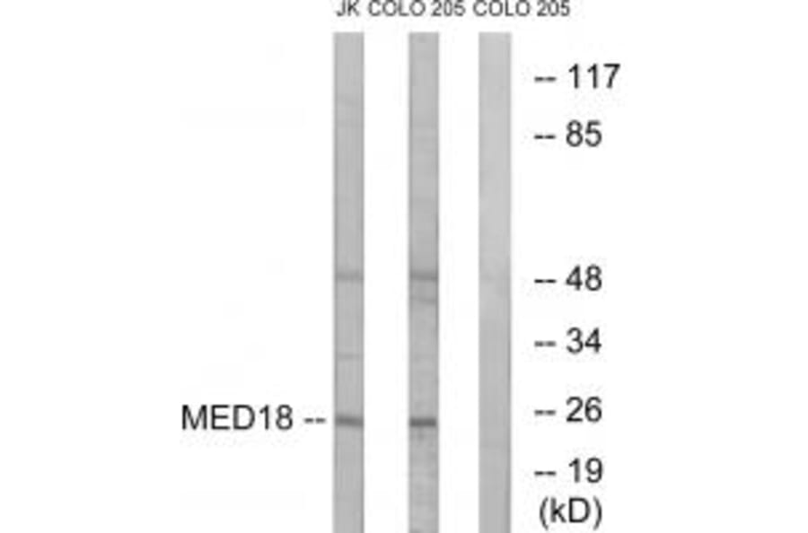 Western blot - MED18 Antibody from Signalway Antibody (34777) - Antibodies.com