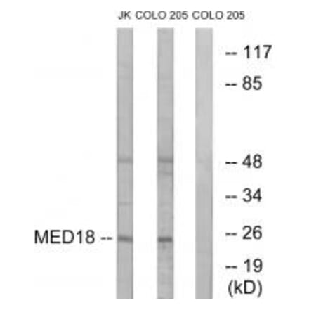 Western blot - MED18 Antibody from Signalway Antibody (34777) - Antibodies.com