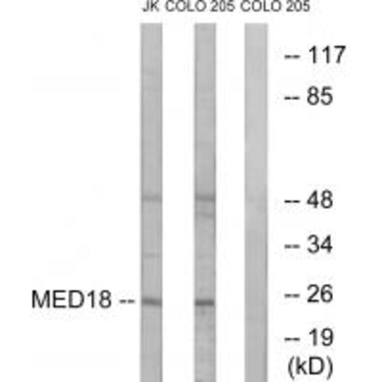 Western blot - MED18 Antibody from Signalway Antibody (34777) - Antibodies.com