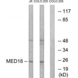 Western blot - MED18 Antibody from Signalway Antibody (34777) - Antibodies.com