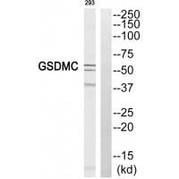 Western blot analysis of extracts from 293 cell, using GSDMC antibody #34782.