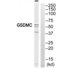 Western blot - GSDMC Antibody from Signalway Antibody (34782) - Antibodies.com