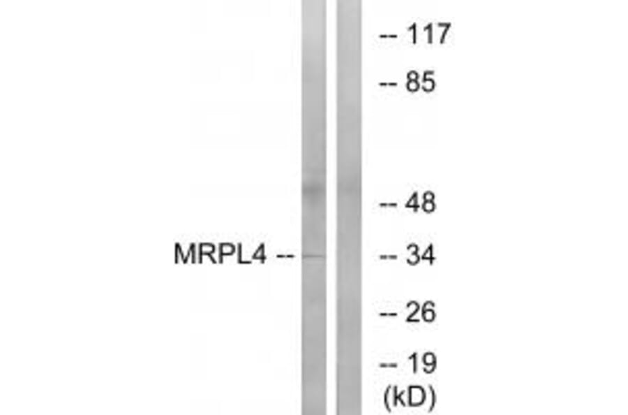 Western blot - MRPL4 Antibody from Signalway Antibody (34803) - Antibodies.com