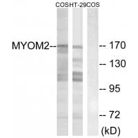Western blot analysis of extracts from COS-7 cells and HT-29 cells, using MYOM2 antibody #34817.