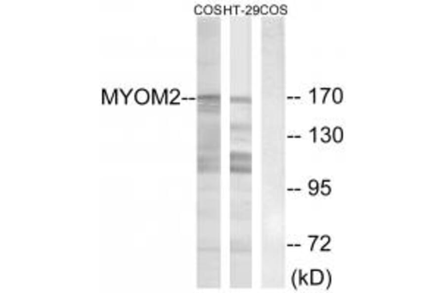Western blot - MYOM2 Antibody from Signalway Antibody (34817) - Antibodies.com